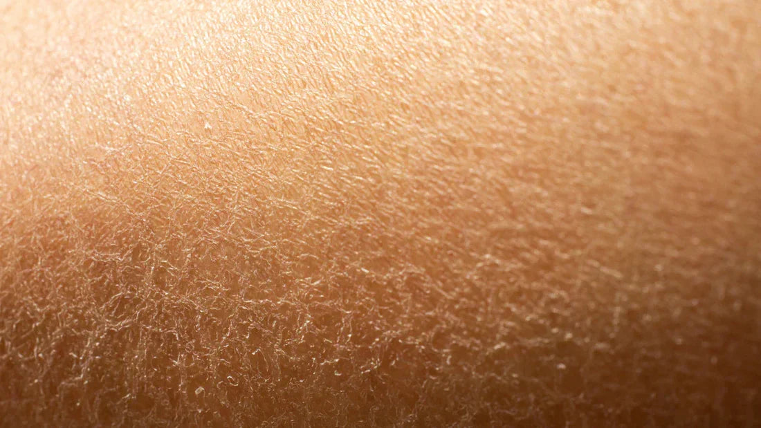 Peau sèche : comprendre le mécanisme pour enfin agir efficacement